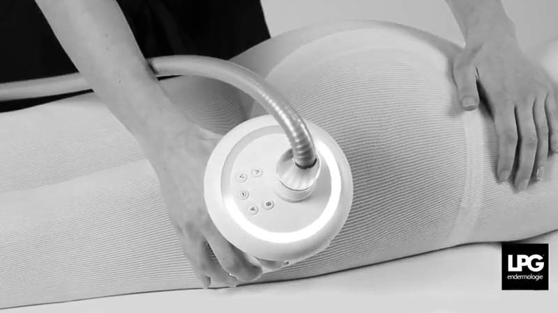 Vidéo vignette firm skin -LPG endermologie