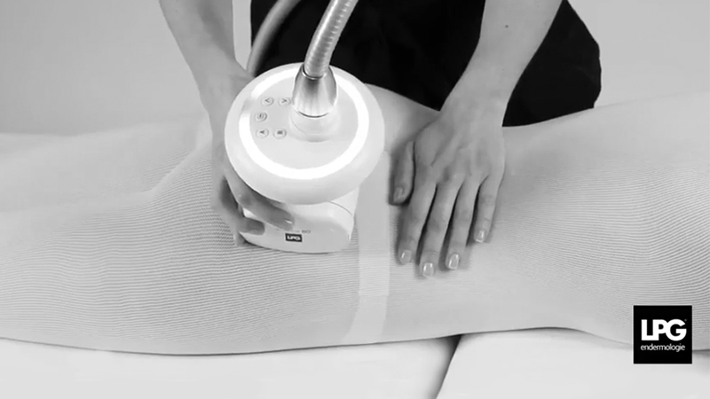 Vidéo vignette smooth cellulite - LPG endermologie