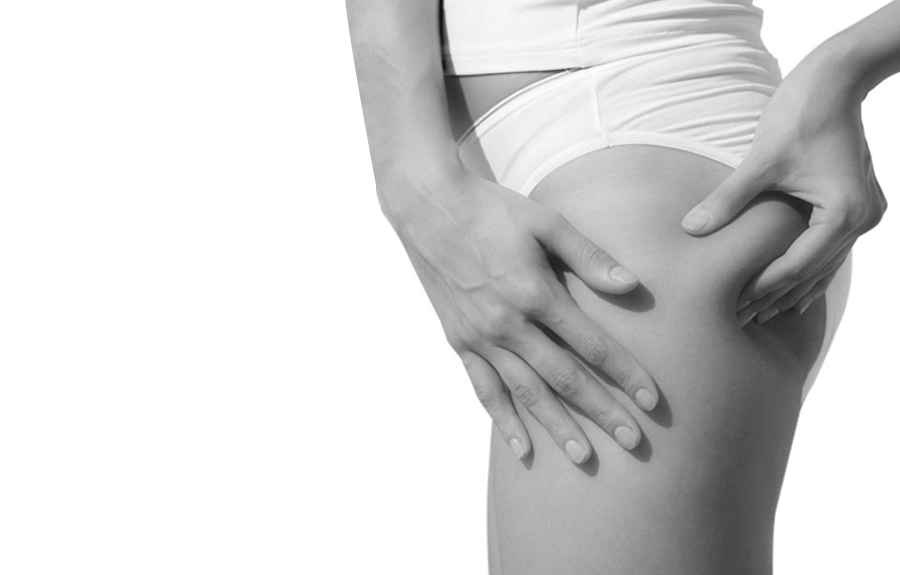 Cellulite adipeuse - LPG endermologie